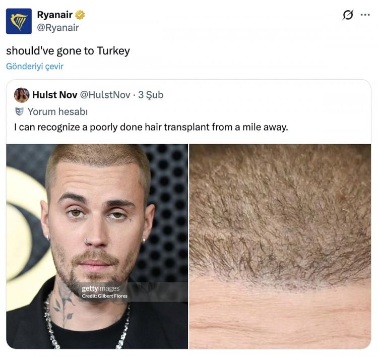 <p><span style="color:#800000"><strong>"T&Uuml;RKİYE'YE GİTMELİYDİN"</strong></span></p>

<p><strong>&Uuml;nl&uuml; hava yolu şirketi Justin Bieber'ın sa&ccedil;larının son haline "T&uuml;rkiye'ye gitmeliydin (Should've gone Turkey) şeklinde not yazarak sa&ccedil; ekimi konusunda T&uuml;rkiye'nin t&uuml;m d&uuml;nyada bir numara olduğunu ifade eden bir paylaşımda bulundu.</strong></p>
