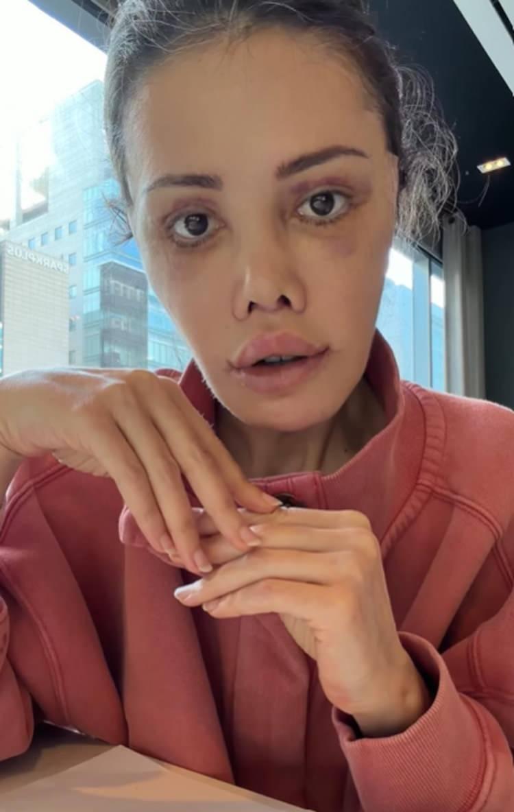 <p>Bir&ccedil;ok sosyal medya kullanıcısı survivor yarışmacısına<strong> "Kendine bunu neden yaptın?", insan kendine bu kadar acı &ccedil;ektirir mi?"</strong>&nbsp;yorumunda bulundu.&nbsp;</p>
