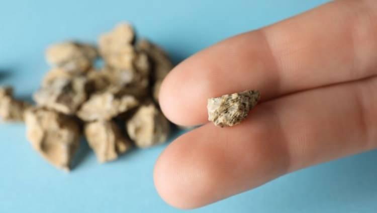 <p><span style="color:#B22222"><strong>KUTUDA B&Ouml;BREK TAŞI VARDI</strong></span></p>
