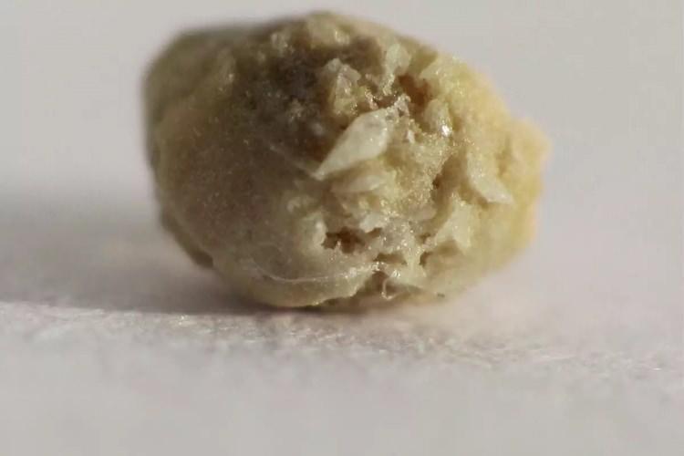 <p><strong>Kuruyan b&ouml;brek taşlarının şekli ve renginin zamanla işlenmemiş altın par&ccedil;alarına benzemesi, hırsızlarda kafa karışıklığına sebep olmuş ve başka bir şey almadan evi terk ettiler.</strong></p>
