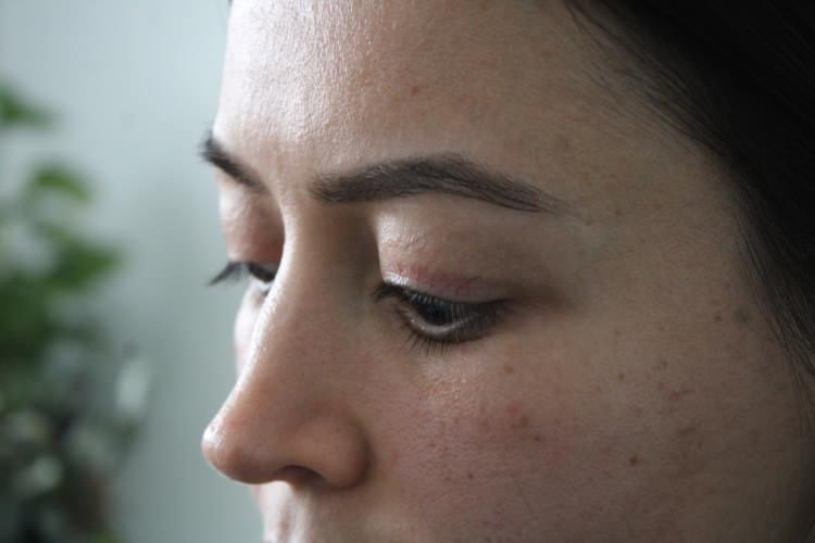 <p><span style="color:#A52A2A"><strong>İTİRAZ DA REDDEDİLDİ&nbsp;</strong></span></p>

<p>&nbsp;</p>

<p>Ayrıca işlemden 11 g&uuml;n sonra sel&uuml;lit tanısıyla medikal tedavi uygulandığı, bu nedenle işlemle ilgili kesin bir değerlendirme yapılamadığı raporda belirtildi.</p>

<p>&nbsp;</p>

<p>Savcılık, Adli Tıp Kurumu raporu doğrultusunda<em> ş&uuml;pheli hakkında kovuşturmaya yer olmadığına karar verdi. </em></p>

<p>&nbsp;</p>

<p>Elif T.'nin bu karara yaptığı itiraz da reddedildi.</p>
