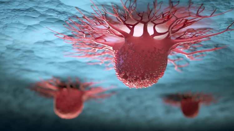 <p><span style="color:#B22222"><strong>ERKEKLERDE &Ouml;NLENEBİLİR RİSK DAHA Y&Uuml;KSEK</strong></span></p>

<p><br />
Kanser t&uuml;rlerine de değinen &Ouml;zkaya, <strong><em>"Akciğer kanseri b&uuml;y&uuml;k oranda sigara ve hava kirliliğiyle ilişkili. Mide kanseri &ccedil;oğunlukla helicobacter pylori enfeksiyonuna bağlanabiliyor. Rahim ağzı yani serviks kanseri ise neredeyse tamamen insan papilloma vir&uuml;s&uuml;nden (HPV) kaynaklanıyor. Bu da bize aşılama ve enfeksiyon kontrol&uuml;n&uuml;n ne kadar hayati olduğunu g&ouml;steriyor.</em></strong></p>
