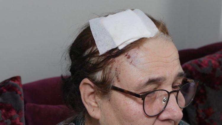 <p><span style="color:#A52A2A"><strong>"SOPA KIRILANA KADAR VURDU"</strong></span></p>

<p>&nbsp;</p>

<p>4 Şubat'ta ev alışverişi yapmak i&ccedil;in dışarı &ccedil;ıkan İsmet Altay ve Hatice Altay, evlerine d&ouml;nerken yine komşularıyla karşılaştı.</p>

<p>&nbsp;</p>

<p>K&uuml;frederek &ccedil;ifti tehdit eden komşu, elindeki sopayla saldırdı. &Ouml;nce Hatice Altay'a defalarca sopayla vuran ş&uuml;pheli, ardından İsmet Altay'a elindeki sopa kırılana kadar vurdu.</p>

<p>&nbsp;</p>

<p>Darbedilen İsmet Altay, cebinden &ccedil;ıkardığı biber gazıyla kendisini savundu. Bir s&uuml;re daha k&uuml;f&uuml;r ve hakaretlerine devam eden ş&uuml;pheli, daha sonra olay yerinden ka&ccedil;tı.</p>
