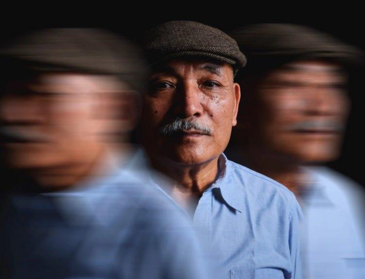 <p><strong>NADİR G&Ouml;R&Uuml;LEN BİR DEMANS T&Uuml;R&Uuml;</strong></p>

<p>CP'ye daha sonra davranışsal frontotemporal demans (FTD) teşhisi konuldu.&nbsp;</p>

<p>CP'nin beyin taramalarında da sağ temporal lobda belirgin doku kaybı ve k&uuml;&ccedil;&uuml;lme tespit edildi.</p>
