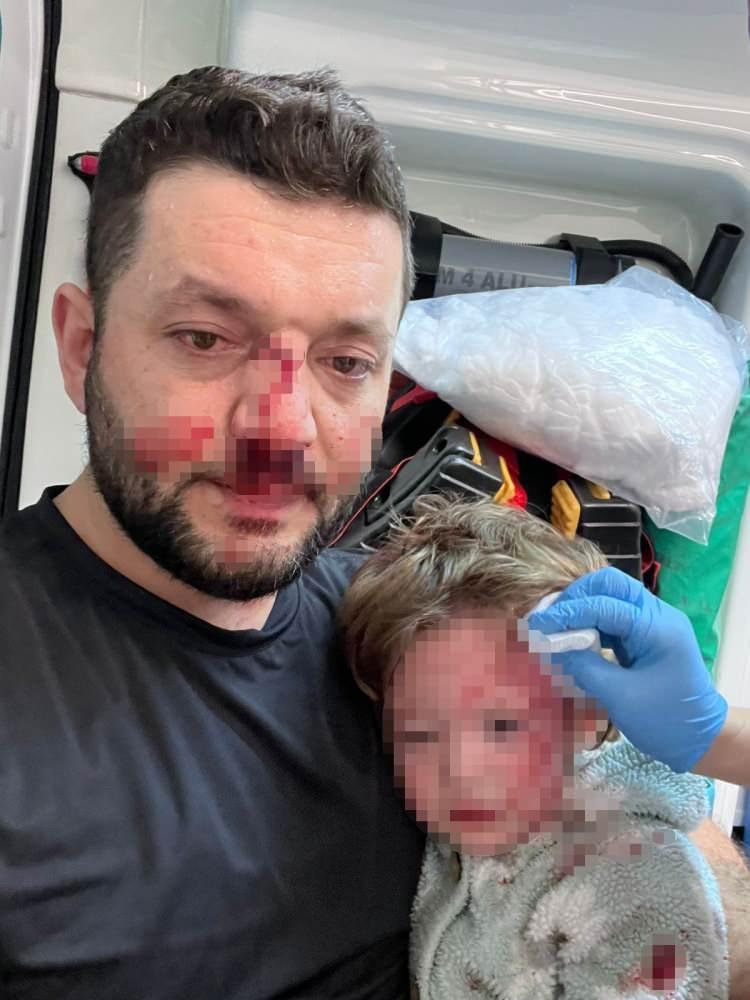 <p>İddiaya g&ouml;re, &Ccedil;ınarcık il&ccedil;esine bağlı Esenk&ouml;y beldesinde bir sene &ouml;nce aldıkları eve taşınan Baca ailesi ile aynı binada oturan Şener E. ve ailesi arasında &ccedil;ocuk g&uuml;r&uuml;lt&uuml;s&uuml;, park, ka&ccedil;ak bina yapıları nedeniyle bir&ccedil;ok kez tartışma yaşandı.&nbsp;</p>
