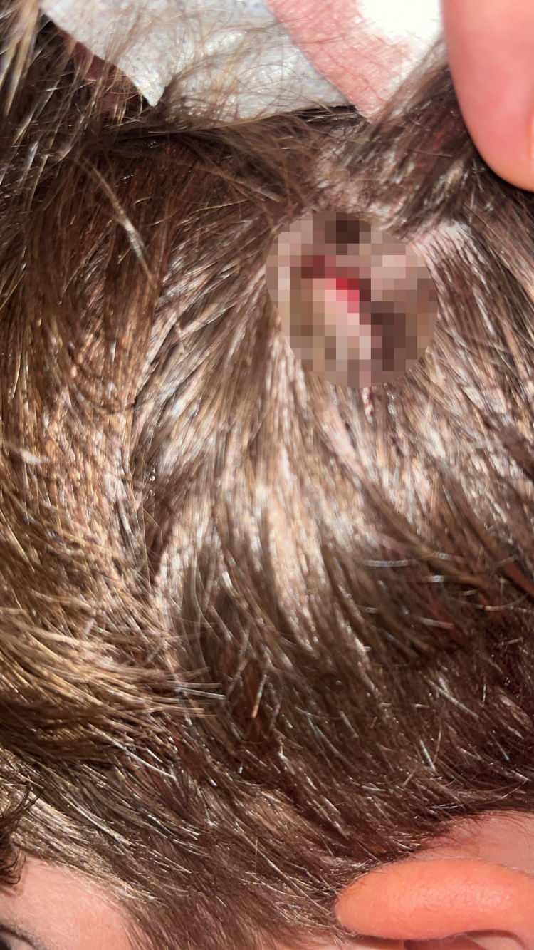 <p><span style="color:#A52A2A"><strong>"CAN G&Uuml;VENLİĞİMİZ YOK"</strong></span></p>

<p>&nbsp;</p>

<p>S&uuml;rekli tehditler aldıklarını ifade eden Muhammed Baca, <strong><em>"Hala aynı şahıslardan, Facebook'tan tehditler alıyoruz. Mesela bazı fotoğraflarımızın altına yorumlar yazmışlar. &lsquo;Jandarma evinizin &ouml;n&uuml;nde beklemezse evinize giremezsiniz, s&uuml;s k&ouml;peği' diye husumetli olduğumuz şahıslar paylaşımlar yapmış. </em></strong></p>

<p>&nbsp;</p>

<p><strong><em>Kapımızın &ouml;n&uuml;ne işte g&uuml;venlik ama&ccedil;lı bir fotokopan koyduk ge&ccedil;en 2-3 g&uuml;n &ouml;nce. Bununla alakalı savcılığa gittik, ifade verdik. Elektrik kesintisi oluyor. G&uuml;venliğimiz, can g&uuml;venliğimiz yok. Belgeler de elimizde var. Savcılığa teslim ettik. </em></strong></p>

<p>&nbsp;</p>

<p><strong><em>Facebook'tan, sosyal medyadan tahrik, tehdit maalesef halen almaya devam ediyoruz. Bu olayla kızımın zaten darp edildiğinde bir kişi tutuklandı, iki kişi serbest. Azmettirici serbest. O g&uuml;n sırtımdan vuran hala serbest. Kolluğun yanında, jandarmaya vuranlar serbest. </em></strong></p>

<p>&nbsp;</p>

<p><strong><em>B&ouml;yle iki g&uuml;n &ouml;nce de yine oğlum Fatih Mira&ccedil; Baca'nın kafasına taş vurulmuş. Jandarmaya gittik, yine tutanak tuttuk. Hastanede tomografi &ccedil;ekildi. Adliyeden tekrar şikayet&ccedil;i olacağız."</em></strong> diye konuştu.</p>
