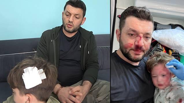 <p>Yalova'da Muhammet Baca (34) ile kucağındaki 14 aylık İkra Baca'nın darbedildiği olayın ardından ailenin 8 yaşındaki oğlu Fatih Mira&ccedil; Baca, sokakta kimliği belirsiz bir kişi tarafından kafasına atılan taş ile yaralandı.</p>
