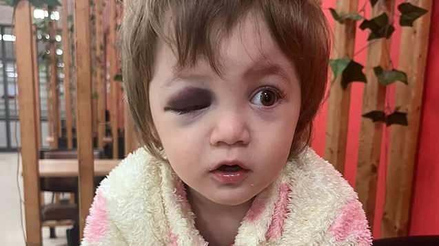 <p>Yaralılar Yalova Eğitim ve Araştırma Hastanesi'nde tedavi altına alındı.&nbsp;</p>

<p><br />
Olay sonrası g&ouml;zaltına alınan Şener E., &ccedil;ıkarıldığı mahkemece tutuklanarak cezaevine g&ouml;nderildi.&nbsp;</p>

<p>&nbsp;</p>

<p>İkra ise 3 g&uuml;nl&uuml;k tedavinin ardından taburcu edildi.</p>
