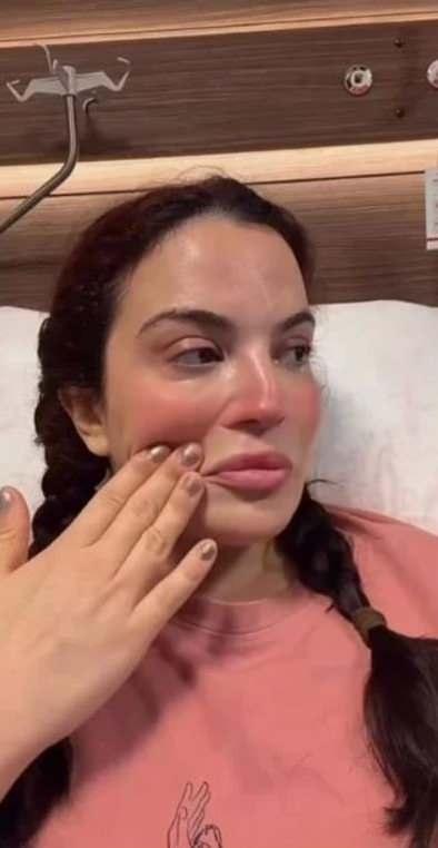 <p>Bekiroğlu, katıldığı bir programda yaşadıklarını; "Sonra 6-7 ay kadar bekledik; en son Ekim ayında bir ameliyat daha oldum. Bu sefer kasımı aldılar ve aşağıya koydular, arayı kapatsın diye. Tam tutmadı. Şimdi de bacağımı kesip i&ccedil;eri koyacaklar. İki ameliyatım daha olacak; biri Ocak'ta, diğeri Mart-Nisan gibi, inşallah." s&ouml;zleriyle a&ccedil;ıklamıştı.&nbsp;</p>
