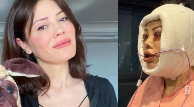 Y&uuml;z nakli olan Didem Ceran, son haline gelen "yapay zeka" yorumlarına yanıt verdi!