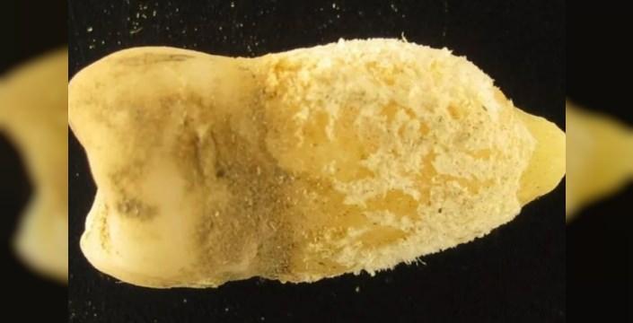 <p><span style="color:#FF0000"><strong>AND DAĞLARI'NDAN G&Uuml;N&Uuml;M&Uuml;ZE ULAŞTI</strong></span></p>

<p><strong>Bu antik varyantın diğer soylardan yaklaşık 10.000 yıl &ouml;nce ayrıldığını ortaya &ccedil;ıkaran analizler, insanların And Dağları'na yerleştiği ilk d&ouml;nemlere işaret ediyor. Yani insanoğlu bu &ouml;l&uuml;mc&uuml;l patojeni ya taşıdı ya da vahşi hayvanlarla temas etmesi sonucu ortaya &ccedil;ıktı.</strong></p>
