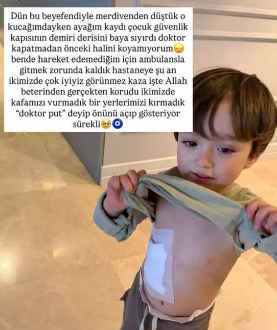 <p>MERDİVENDEN D&Uuml;ŞM&Uuml;ŞT&Uuml;: SON DURUMUNU A&Ccedil;IKLADI</p>

<p>Ge&ccedil;tiğimiz hafta ikiz &ccedil;ocuklarından Ayel ile merdivenden d&uuml;şerek y&uuml;rekleri ağza getiren Tatlıses, minik Ayel'in karnından yaralandığını a&ccedil;ıklamıştı.</p>
