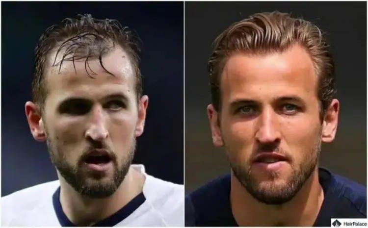 <p><span style="color:inherit"><span style="color:rgb(178, 34, 34)"><strong>&nbsp;HARRY KANE</strong></span></span></p>

<p>&nbsp;</p>
