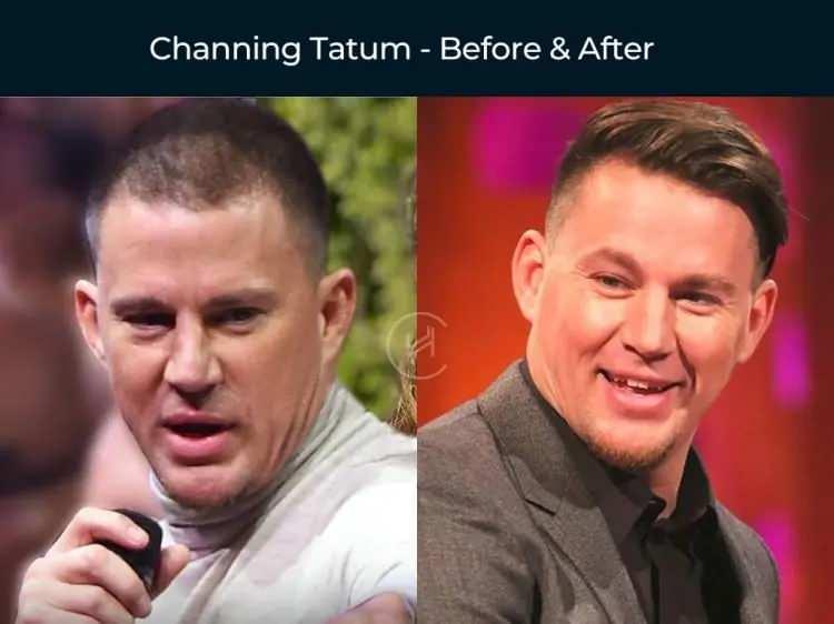 <p><span style="color:inherit"><span style="color:rgb(178, 34, 34)"><strong>CHANNING TATUM</strong></span></span></p>

<p>&nbsp;</p>
