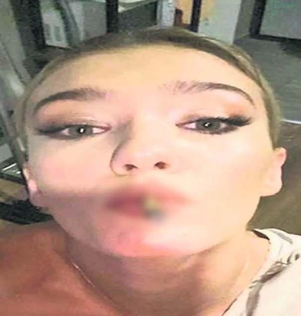 <p>Bunun yanı sıra D&ouml;ngel'in y&uuml;z&uuml;n&uuml;n de g&ouml;r&uuml;nd&uuml;ğ&uuml; ve madde kullanırken &ccedil;ekildiği değerlendirilen fotoğraflar dijital delil olarak kayıt altına alındı. Galeride ayrıca kokain ve esrar olduğu değerlendirilen maddelerin yakın &ccedil;ekim fotoğrafları da bulundu. Soruşturma devam ediyor.</p>
