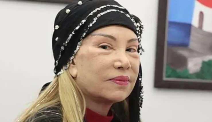 <p>Estetik yaptıran &uuml;nl&uuml;ler arasına 4 yıl &ouml;nce katılan kadife sesiyle bilinen &uuml;nl&uuml; sanat&ccedil;ı Bedia Akart&uuml;rk yaptrdığı y&uuml;z gerdirme ameliyatı &ccedil;ok konuşulmuştu.&nbsp;</p>
