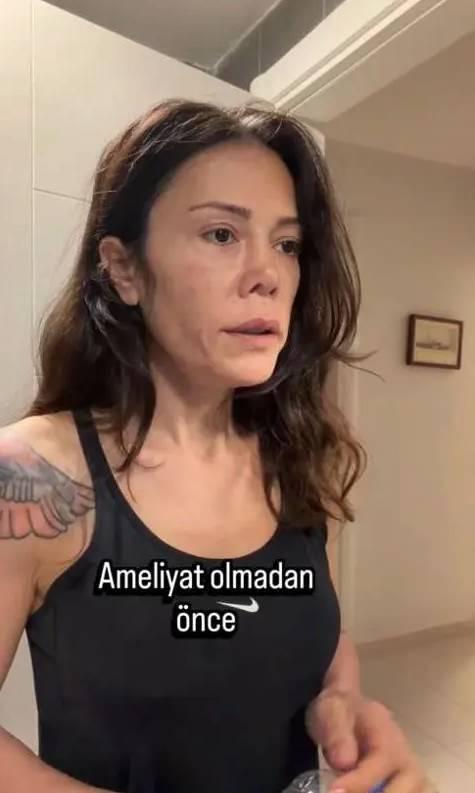 <p><strong>KORE'DE Y&Uuml;Z NAKLİ OLMUŞTU</strong></p>

<p>Yaptırdığı y&uuml;z nakliyle g&uuml;nlerdir konuşulan eski survivor yarışmacısı gelen yorumlar karşısında &ouml;fkeden deliye d&ouml;nd&uuml;.&nbsp;</p>
