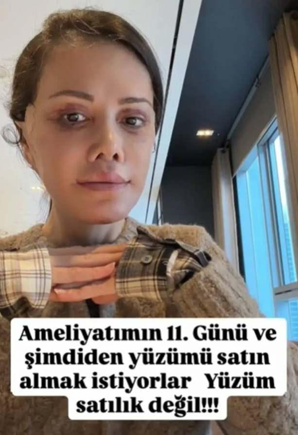 <p><em>Şimdi &ouml;n&uuml;mde yeni ve zor bir ameliyat s&uuml;reci var. Bu s&uuml;reci, Ocak ayında olduğu gibi her g&uuml;n hakaret okuyarak ge&ccedil;irmek istemiyorum. Bedenim iyileşmeye &ccedil;alışırken ruhumu da nefret dolu yorumlardan korumaya &ccedil;alışmaktan yoruldum.</em></p>

<p>&nbsp;</p>
