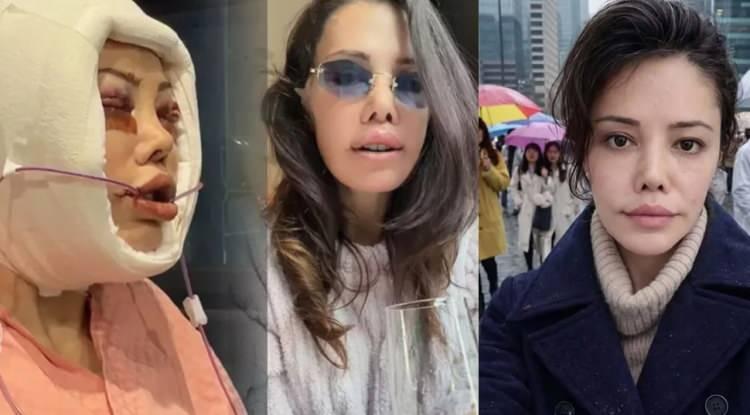 Kore'de y&uuml;z nakli sonrası &ouml;l&uuml;m dilekleriyle karşılaştı: Didem Ceran isyan etti