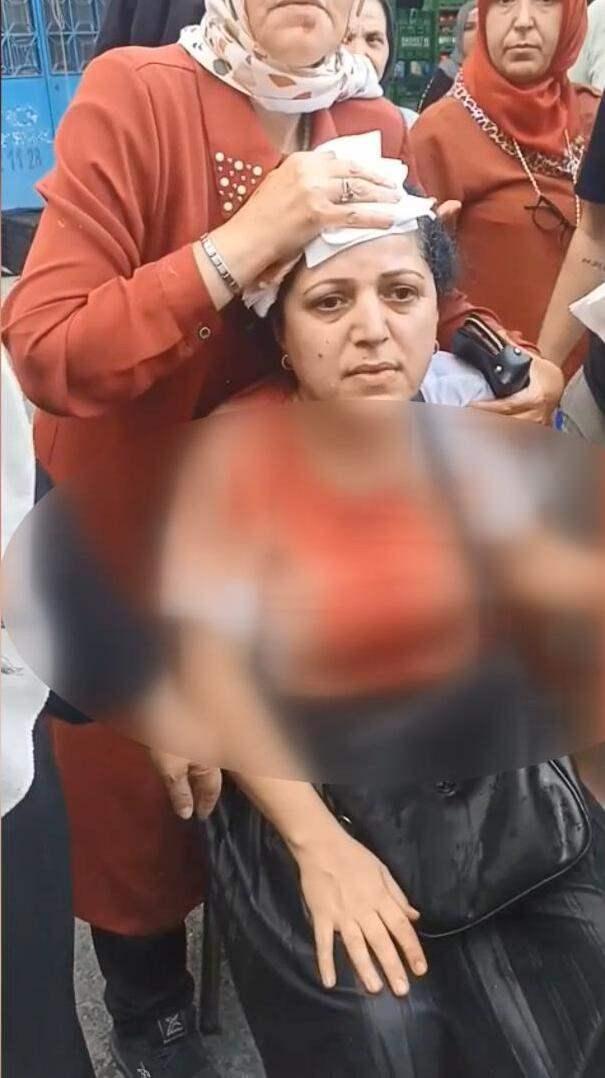 <p><span style="color:#A52A2A"><strong>"BİR ANDA VURDU KAN REVAN İ&Ccedil;İNDE KALDIM"&nbsp;</strong></span></p>

<p>&nbsp;</p>

<p>Olayla ilgili konuşan Nurcihan Yıkılkan, olayı şu s&ouml;zlerle anlattı:&nbsp;</p>

<p>&nbsp;</p>

<p><strong><em>"Ben temizlik yapıyordum. 18.30-19.00 sıralarında annem armut istedi. Annemin g&ouml;zleri g&ouml;rm&uuml;yor; engelli., ağzında da dişleri yok. 'Anne alacağım tamam' dedim. Evde de iş yapıyordum. O saatlerde pazara &ccedil;ıktım. Tezg&acirc;h vardı. Orada biraz &ccedil;&uuml;r&uuml;k meyveler vardı. Anneme g&ouml;re bakıyordum.&nbsp;</em></strong></p>

<p>&nbsp;</p>

<p><strong><em>Orada adam, 'Ne yapıyorsun' dedi. 'Abi b&ouml;yle b&ouml;yle, annemin g&ouml;zleri g&ouml;rm&uuml;yor, dişleri yok ağzında. Olmuş armutlardan alacağım' dedim. 'Alamazsın' dedi. 'Abi l&uuml;tfen' dedim. 'Senin anneni' diyerek k&uuml;f&uuml;r etti 'Alamazsın' dedi.&nbsp;</em></strong></p>

<p>&nbsp;</p>

<p><strong><em>Orada bir anda kafama vurdu. Ne olduğumu anlayamadım; kan revan i&ccedil;inde kaldım. Kadınların hali b&ouml;yle mi olmalı? Bunların anneleri, babaları, &ccedil;olukları, &ccedil;ocukları yok mu? Pazara gidemeyecek miyiz? Biz istediğimizi alamayacak mıyız?"</em></strong></p>

<p>&nbsp;</p>

<p><span style="color:#A52A2A"><strong><em>KAYNAK: DHA&nbsp;</em></strong></span></p>
