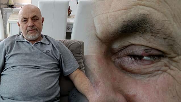 <p>Trabzon'da uzağı ve yakını g&ouml;remediği i&ccedil;in kullandığı g&ouml;zl&uuml;kten kurtulmak amacıyla &ouml;zel bir hastanede akıllı lens taktıran Ali İhsan Aydın&rsquo;ın (56) sol g&ouml;z&uuml;, operasyon sonrası g&ouml;rme yetisini kaybetti<em>. <span style="color:#A52A2A"><strong>Sol g&ouml;z&uuml; alınan Aydın, yaşadığı dehşeti anlattı.</strong></span></em></p>
