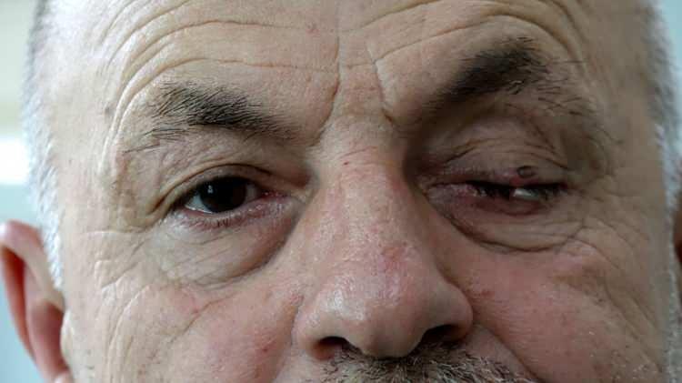 <p>Aydın, araştırmaları sonucu 1,5 ay &ouml;nce kent merkezinde gittiği &ouml;zel bir g&ouml;z hastanesinde ameliyat olmaya karar verdi.</p>

<p>&nbsp;</p>

<p>Aydın, sol g&ouml;z&uuml;ne akıllı mercek takılması i&ccedil;in ameliyata alındı.&nbsp;</p>
