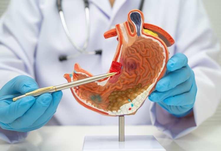 <p>Şekerli i&ccedil;eceklerin mide kanserine nasıl yol a&ccedil;abileceği mekanizması hen&uuml;z kesinleşmemiş olsa da araştırmacılar; kilo alımı, ins&uuml;lin direnci, steroid hormonu dengesizliği, iltihaplanma, DNA hasarı ve bağırsak mikrobiyotası bozuklukları gibi fakt&ouml;rlerin rol oynayabileceğini değerlendiriyor.&nbsp;</p>

<p>&nbsp;</p>
