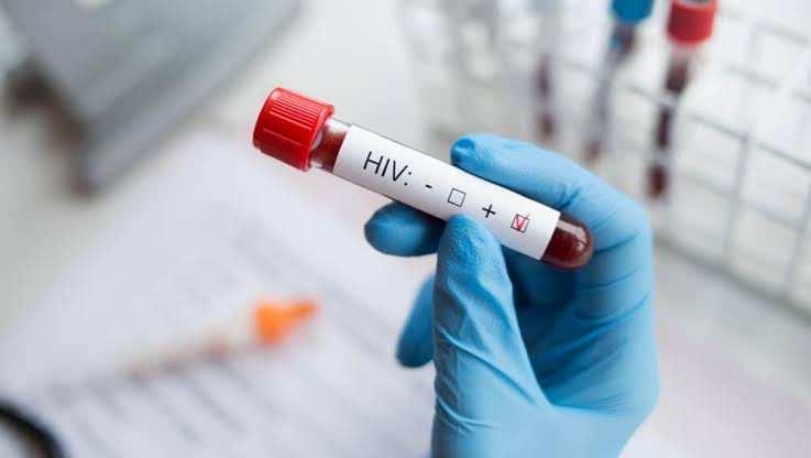 <p><span style="color:#B22222"><strong>AIDS</strong></span></p>
