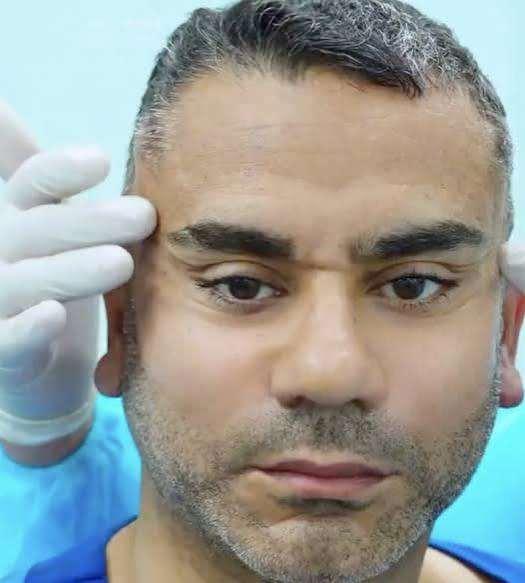<p>Operasyon sonrasında g&ouml;r&uuml;nt&uuml;leri dikkat &ccedil;ekti. Ameliyat &ouml;ncesi ve sonrası karelerde y&uuml;z hatlarında belirgin bir değişim g&ouml;r&uuml;l&uuml;rken, operasyona ilişkin uzmanlardan değerlendirme geldi.</p>
