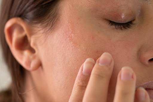 <p>Medical Point Gaziantep Hastanesi Dermatoloji Uzmanı Dr. Halil İbrahim Gazioğlu, sonbahar aylarında cildin &ccedil;evresel değişikliklere karşı daha hassas hale gelebildiğini belirterek bazı &ouml;nlemler alınması gerektiğini belirtti.</p>
