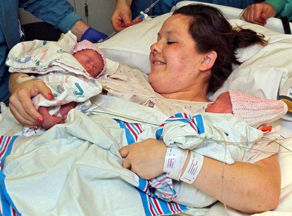 Kız bebeklere Jenna ve Jillian ismi verildi. Doktorlar, ikizlerin el ele tutuşarak dünyaya gelmesinin 10 bin gebelikte bir görülen bir durum olduğunu açıkladı