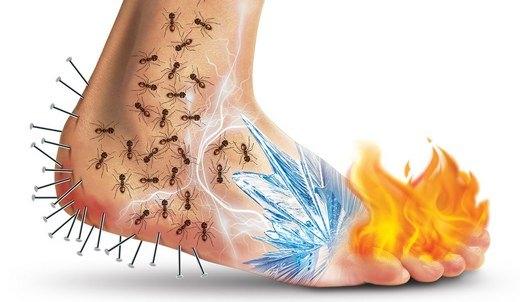 <p>Ayak ve el eklemlerindeki yanma, karıncalanma gibi belirtiler nöropatik ağrıların ortaya çıktığının göstergesi olabilir. Pkei nöropatik ağrılar nedir ve belirtileri nelerdir? İşte nöropatik ağrıların belirtileri...</p>
