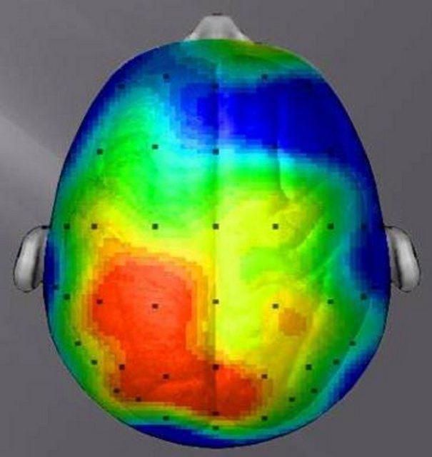 <p>20 dakikalık y&uuml;r&uuml;y&uuml;ş&uuml;n ardından ise b&ouml;yle...</p>