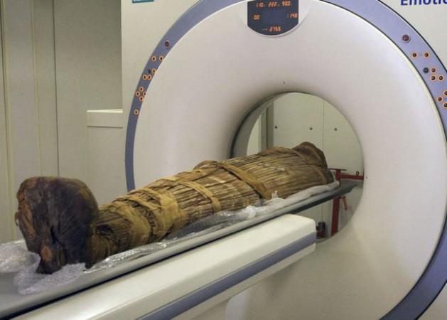 Araştırmaya destek veren İsviçre'nin Zürih Üniversitesi'nden Dr. Frank Ruehli de damar tıkanıklığının genetik ve insanlık tarihi kadar eski olabileceğini söyledi.