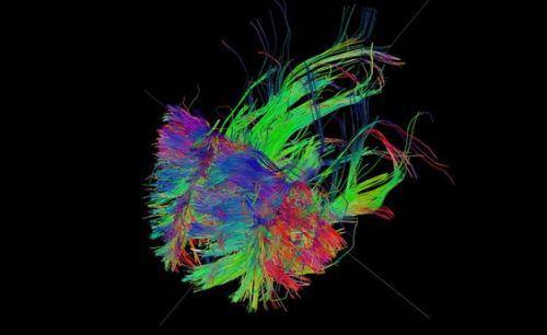 <p>İkinci olarak myelin kılıfıyla çevrili sinir hücreleri liflerinin bulunduğu beyindeki beyaz bölgeyi kaplayan anatomik ''devreler'' gözler önüne serildi.</p>
