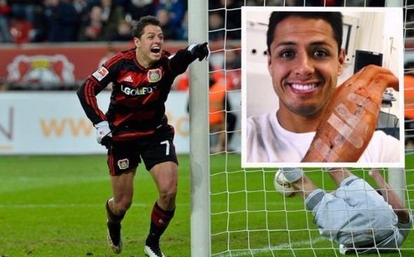 <p>Javier Hernández<br />
<br />
Chicharito evindeki merdivenlerden yuvarlanmış ve elini fotoğrafta görüldüğü gibi perişan ederek sahalardan uzak kalmıştı.</p>