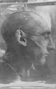 <p>Nazi tıbbı deneylerinin kurbanlarından biri.</p>

<p> </p>
