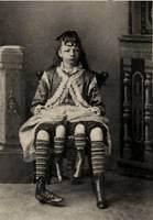 <p>Myrtle Corbin Josephine Myrtle Corbin ABD’nin Tennessee eyaletinde 1868′de doğdu. Doğuştan 4 bacaklı doğdu. Buna ana rahmindeki ikizinin ayrılmaması yol açtı</p>