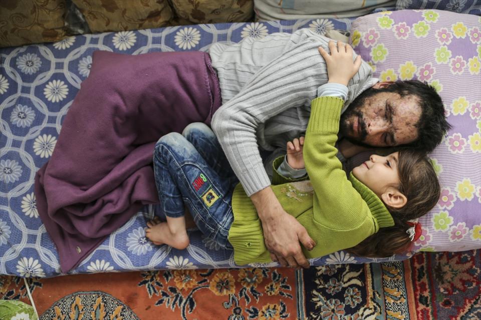 <p>İnsan Hak ve Hürriyetleri (İHH) İnsani Yardım Vakfı, Suriye'nin İdlip kentinde rejim birliklerine ait savaş uçaklarından atılan varil bombası nedeniyle iki bacağını, sağ el parmaklarını, gözlerini ve işitme yetisini kaybeden 27 yaşındaki Mamun Halid Nasır'a yardım elini uzattı. Nasır ailesine gıda, soba, kömür ve yatak yardımı yapıldı. Nasır'ın 5 yaşındaki kızı Gözyaşı da babası tedavi edileceği için çok mutlu olduğunu belirtti. </p>
