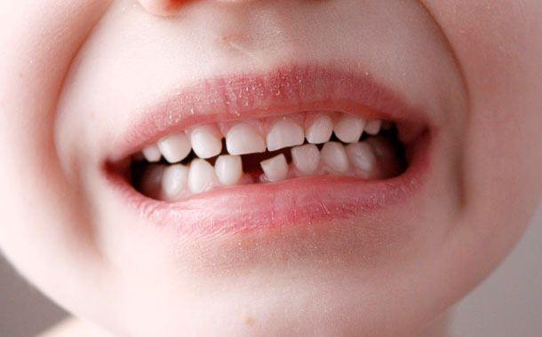 <p>Çocuğuna ait ilk dişler her ebeveyn için önemlidir.</p>
