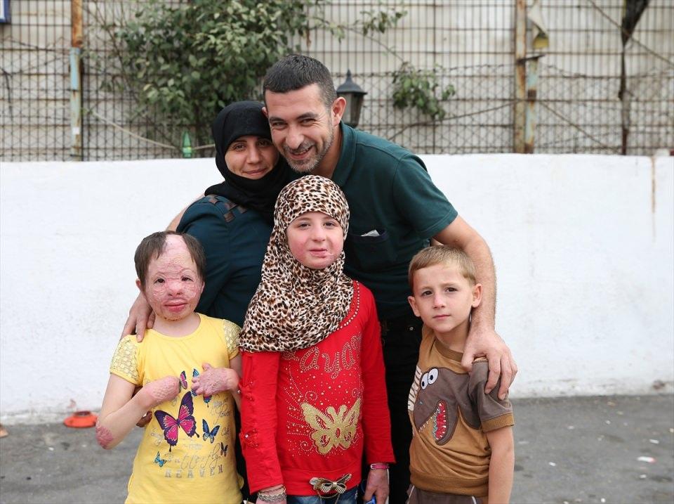 <p>Hayırseverlere teşekkür eden Mekzum, "Geçen yıl Aralık ayının 12. günü Rus uçakları çok bomba attılar. İş yerimdeydim. Eve geldiğimde 5 yaşındaki Ahmed ve 3 aylık kızım Aişe'yi orada kaybettim. 8 yaşındaki Hiba ve 10 yaşındaki Merva yandı. Evimiz yaşanmaz hale geldi. Suriye'deki hastaneler bir şey yapamadı.</p>
