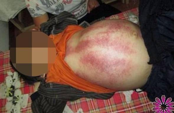 <p>Sözde ‘şifacı’ pek çok şehirde ‘tokat seminerleri’ veriyor ve modern tıbbın insanları zehirlediğini iddia ediyor.</p>

<p> </p>
