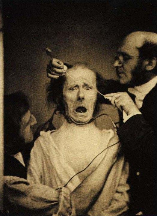 <p>Nörolog Duchenne de Boulogne, bir adamın yüzüne elektrik vererek yüz kaslarının çalışmasını inceliyor. (1862)<br />
<br />
<em>Fransa</em></p>

<p> </p>
