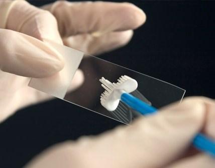 <p><strong>PAP- SMEAR TESTİ</strong></p>
