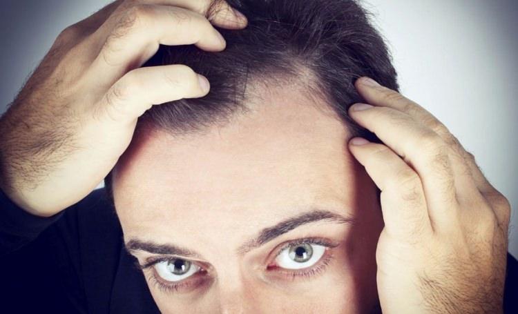 <p>Saç dökülmesi, nedeni ne olursa olsun önlenebilir, ancak kaybedilen saçı geri kazanma her zaman mümkün değil. </p>
