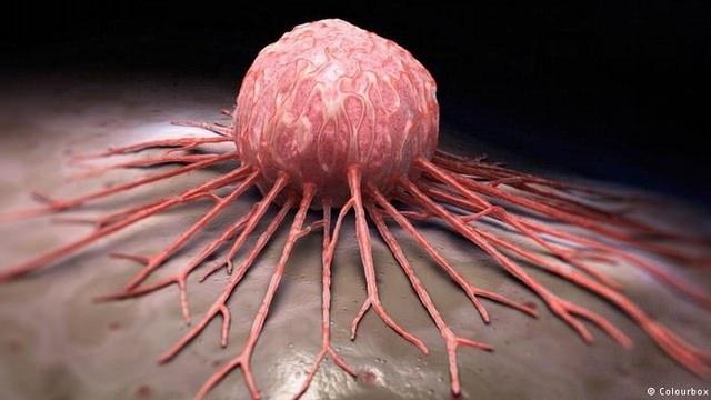 <p>California Üniversitesinde devam eden kanser araştırmalarında, kanser hücrelerinin daha az yapışkan olanlarının diğer dokulara zarar verme olasılığının daha yüksek olduğu bulgusuna rastlandı</p>
