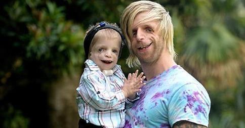<p>Kendisi gibi Treacher-Collins sendromu olan, 2 yaşındaki hayranı Zackary Walton ile tanışmak için Avustralya'ya gitmiş.</p>
