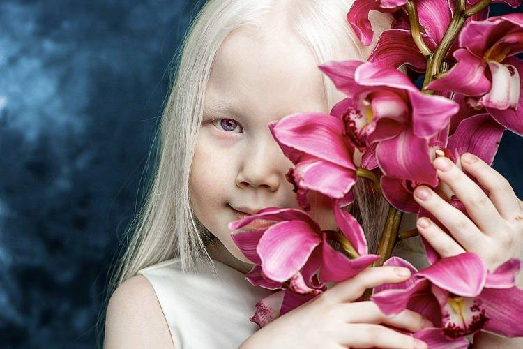 <p>Kızının ailedeki tek albino çocuk olduğunu belirten anne Elena, Nariya’nın modellik ajansları tarafından ilgi gördüğünü ancak yaşı nedeniyle çalışmasını istemediğini söyledi.</p>
