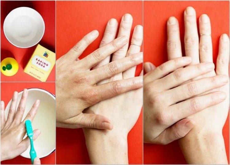 <p><strong>ELDEKİ LEKELER</strong></p>

<p>Diş fırçasını kullanarak lekeleri limonlu su ve karbonat ile yok edebilirsiniz.</p>

<p> </p>
