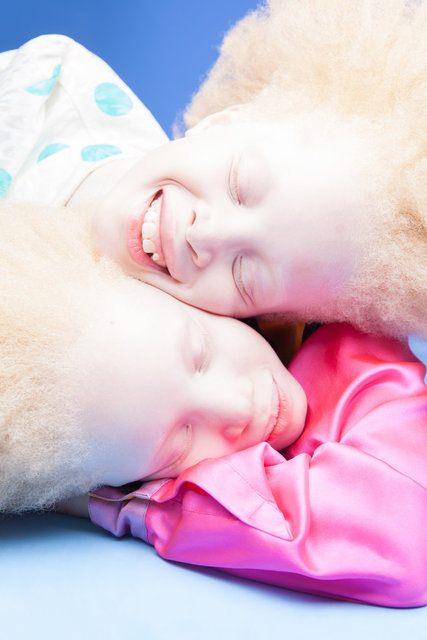 <p>11 yaşındaki Brezilyalı ikizler<strong> Lara ve Mara Bawar</strong>, albizimle fark yaratıyor.</p>
